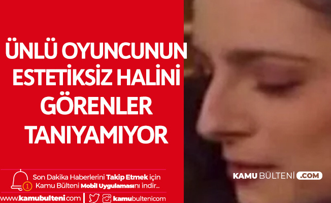 Bikinili Pozuyla Adindan Soz Ettiren Mine Tugay In Estetiksiz Hali De Gundeme Geldi