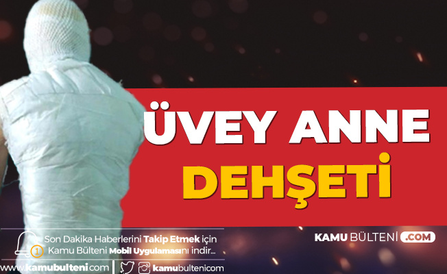 İstanbul'da Üvey Anne Dehşeti! Kaynar Suyu Başından Aşağı Döktü