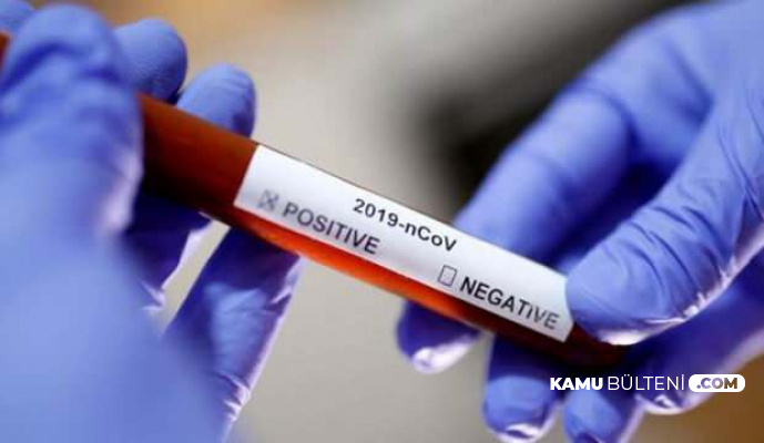 23 Yaşındaki Genç İTÜ'lü Koronavirüs Nedeniyle Hayatını Kaybetti
