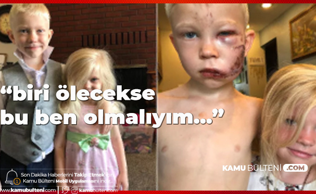 4 Yaşındaki Kız Kardeşi için Ölümü Göze Aldı 4 Yaşındaki Kız Kardeşi için Ölümü Göze Aldı