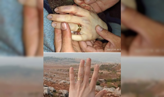 Suriyeli Meryem, düğününden 6 gün sonra rejim saldırılarında hayatını kaybetti