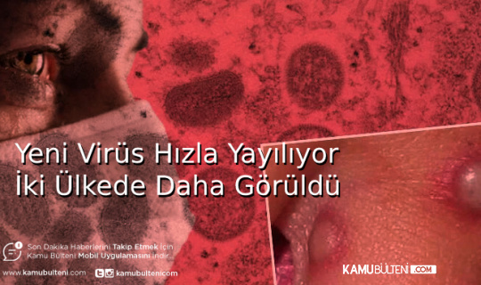 Yeni Virüs Hızla Yayılıyor İki Ülkede Daha Görüldü