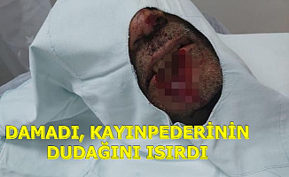 Damat, Kayınpederinin Dudağını Isırarak Parçaladı