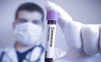 1. Basamak Testleri Başarılı: Ercüment Ovalı'dan Aşı Açıklaması Geldi