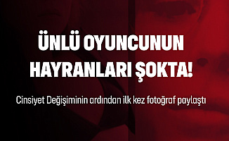 Ünlü Oyuncu Cinsiyet Değişikliğinin Ardından İlk Kez Fotoğraf Paylaştı