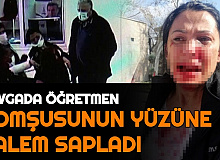 Kavgada Öğretmen, Tartıştığı Kadının Yüzüne Kalem Sapladı