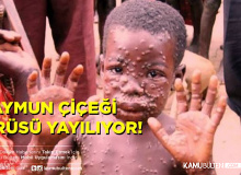 Maymun Çiçeği Virüsü  Avrupa'da Yayılıyor: 5 Ülkede Görüldü Tedavisi Yok