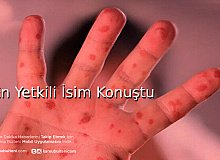 Maymun Çiçeği Salgına Dönüşür Mü?