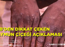 Türk Tabipler Birliği'nden  Dikkat Çeken Maymun Çiçeği Açıklaması
