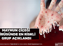 Maymun Virüsünde En Riskli Grup Açıklandı Bu Üç Semptoma Dikkat