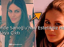 Hande Sarıoğlu’nun Estetiksiz Hali Ortaya Çıktı!